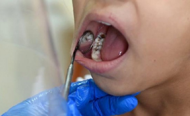 Tedavi edilmeyen diş iltihabında ölümcül 'mediastinit' riski